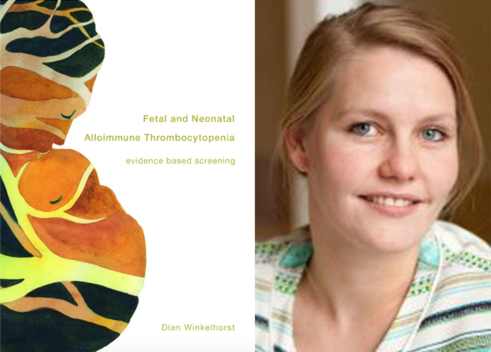 proefschrift fetal and neonatal alloimmune thrombocytopenia dian winkelhorst foetale therapie