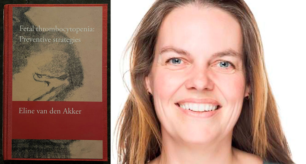 proefschrift fetal thrombocytopenia preventive strategies eline van den akker foetale therapie