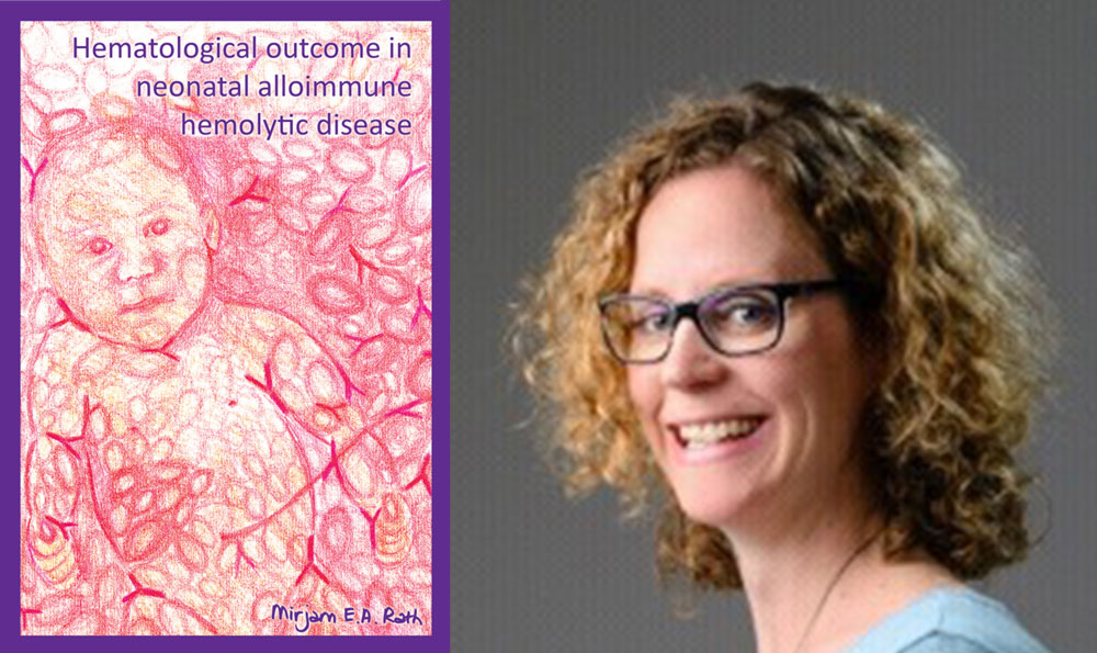 proefschrift hematological outcome in neonatal alloimmune hemolytic disease mirjam rath foetale therapie