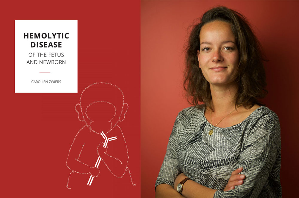 proefschrift hemolytic disease of the fetus and newborn carolien zwiers foetale therapie