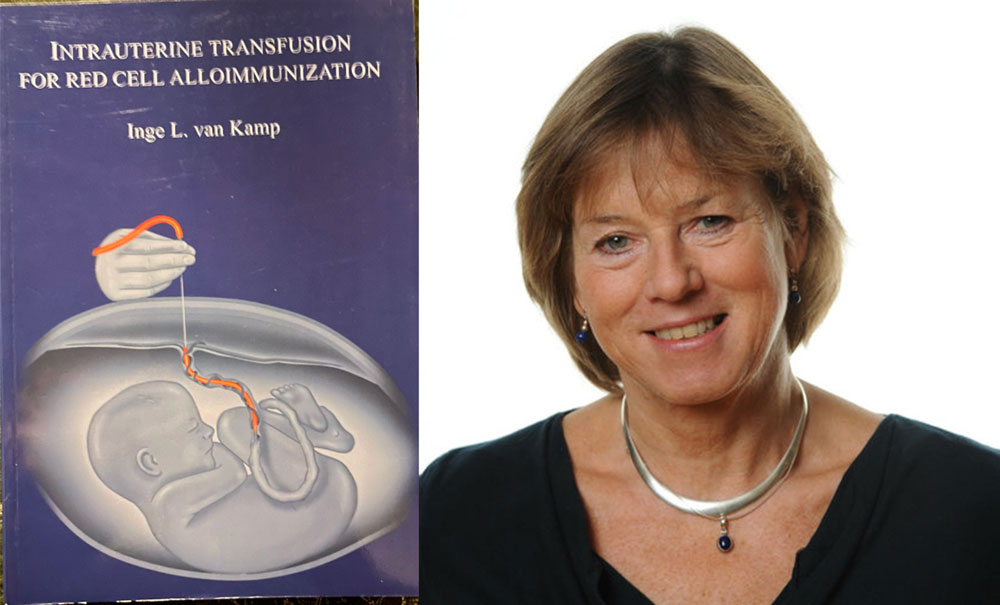 proefschrift intrauterine transfusion for red cell alloimmunization inge van kamp foetale therapie