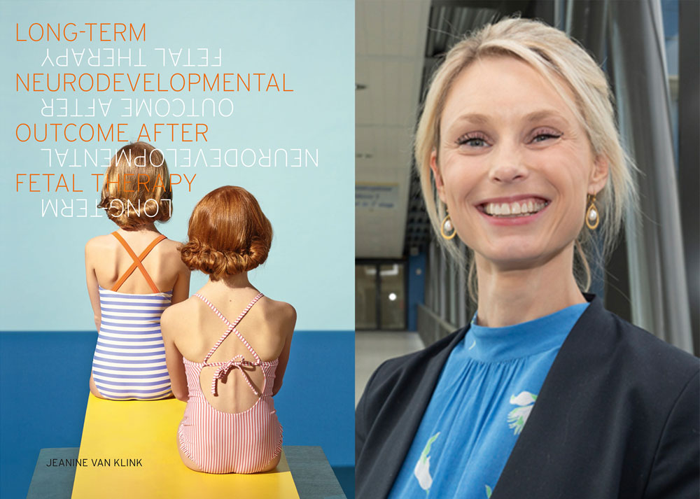 proefschrift long term neurodevelopmental outcome after fetal therapy jeanine van klink foetale therapie