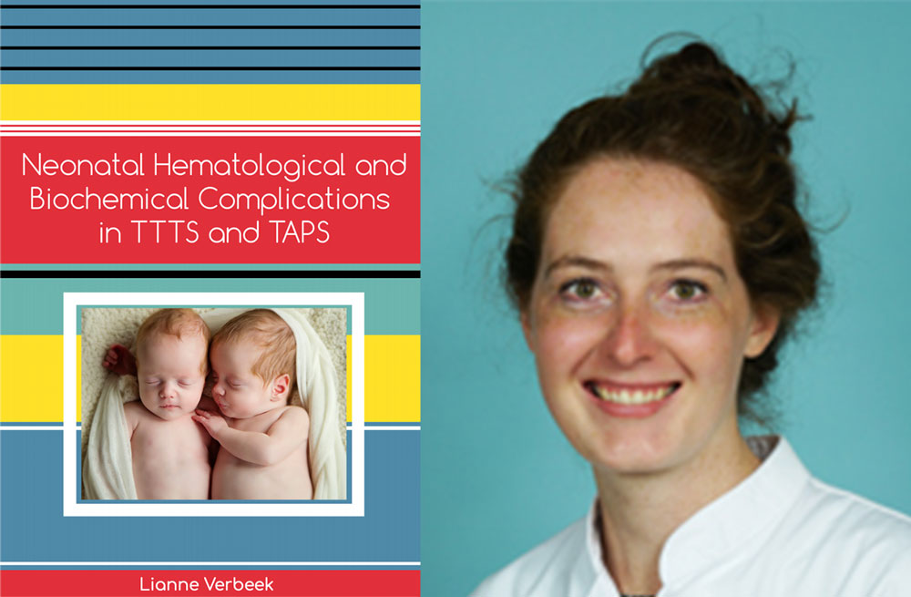proefschrift neonatal hematological and biochemical complications in ttts and taps lianne verbeek foetale therapie