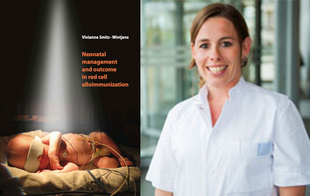 proefschrift neonatal management and outcome in red cell alliommunization viviane smits wintjens foetale therapie