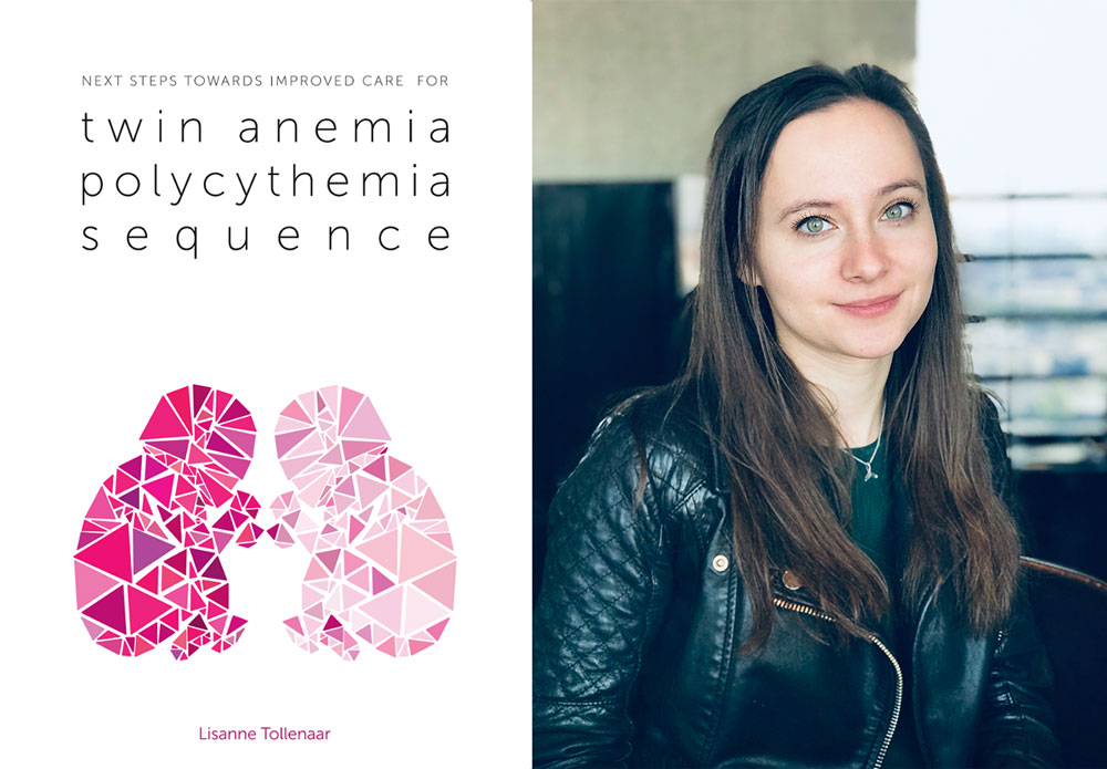 proefschrift next steps toward improved care for twin anemia polycythemia sequence lisanne tollenaar foetale therapie