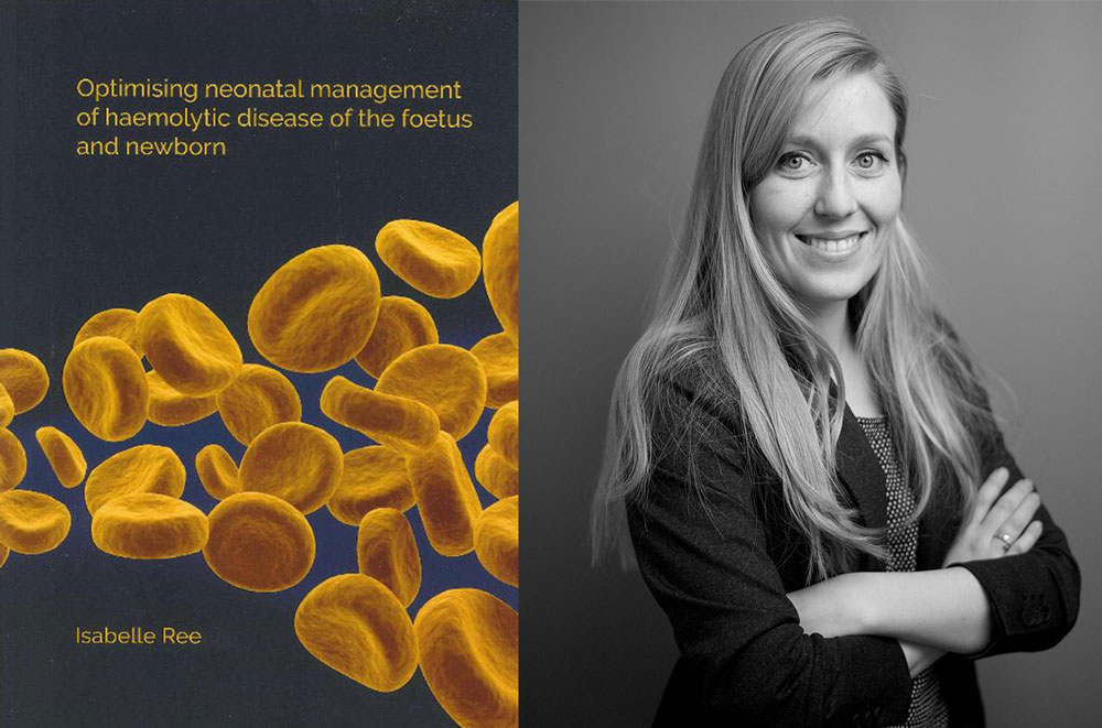 proefschrift optimising neonatal management of haemolytic disease of the foetus and newborn isabelle ree foetale therapie