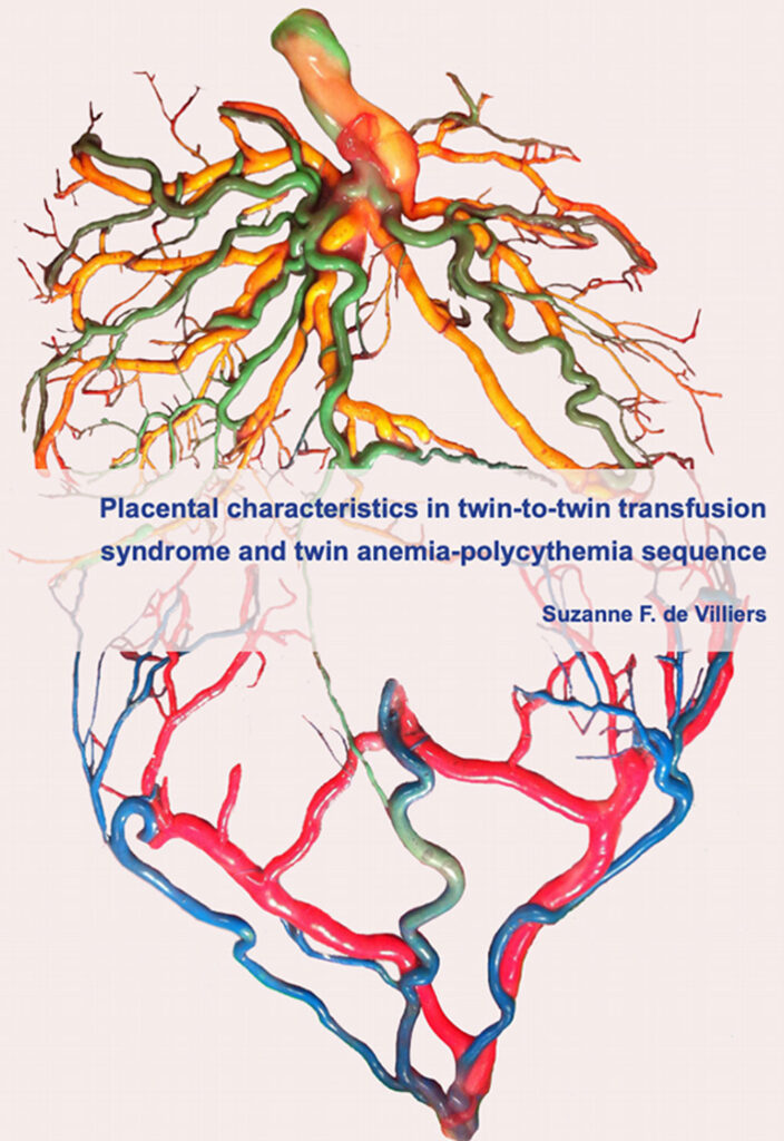 proefschrift placental characteristics in tts and twin anemia polycythemia sequence suzanne de villiers foetale therapie