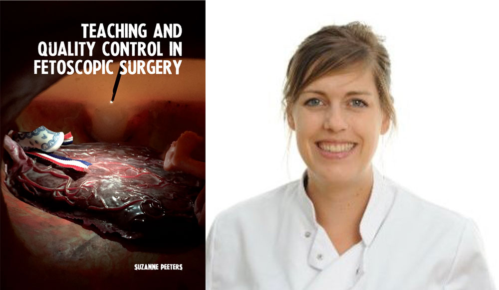 proefschrift teaching and quality control in fetoscopic surgery suzanne peeters foetale therapie