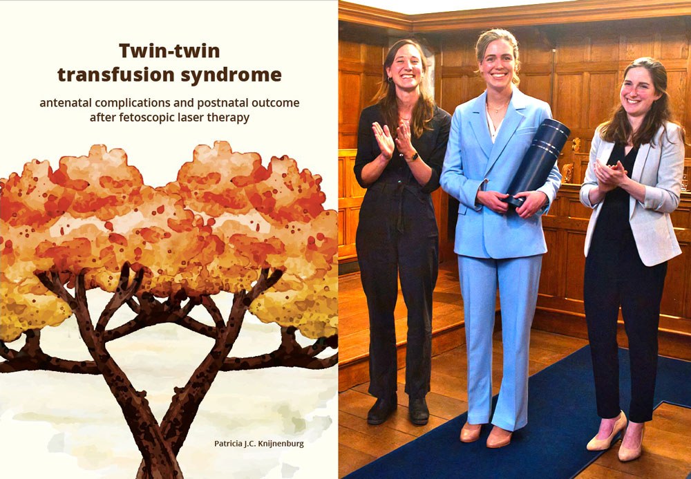 proefschrift twin to twin transfusion syndrome patricia knijnenburg foetale therapie