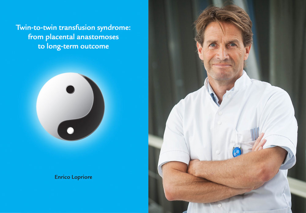proefschrift twin to twin transfusion syndrome from placental anastomoses to long term outcome enrico lopriore foetale therapie