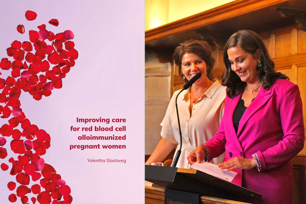 proefschrift improving care for red blood cell alloimmunized pregnant women yolentha slootweg foetale therapie leiden