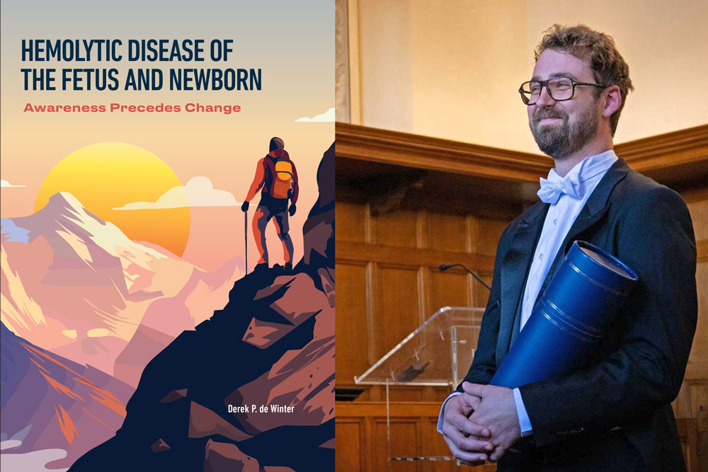 proefschrift hemolytic disease of the fetus and newborn derek de winter foetale therapie leiden